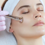 Is Microdermabrasion Worth It?