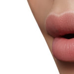 How to Avoid “Duck Lips” From Lip Augmentation