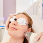 How Fraxel Laser Treatments Can Reduce Acne Scars