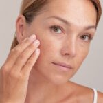 4 Fraxel Solutions for Skin Pigmentation Issues